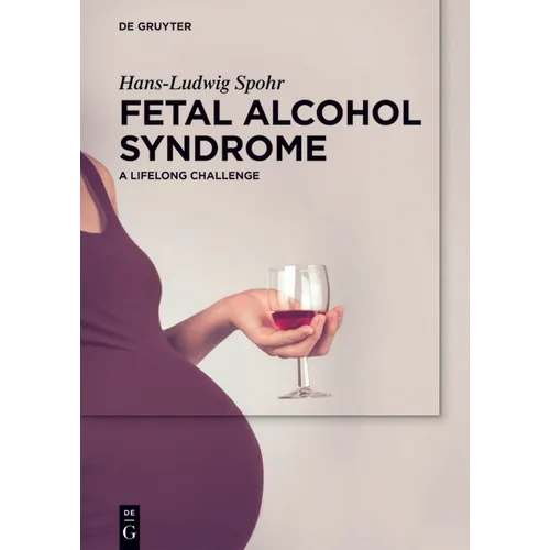 Fetal Alcohol Syndrome: A Lifelong Challenge