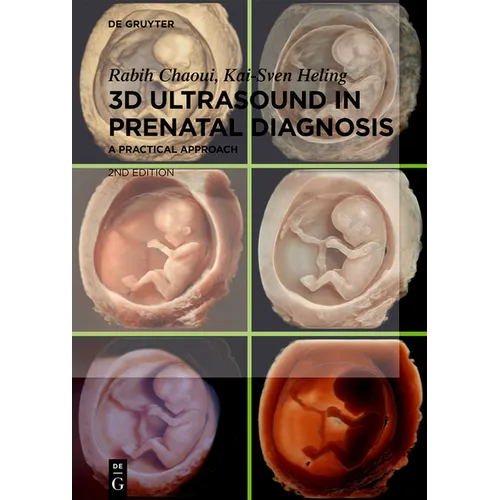 3D Ultrasound in Prenatal Diagnosis: A Practical Approach