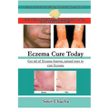Eczema Cure Today - Get rid of Eczema forever natural ways to cure Eczema
