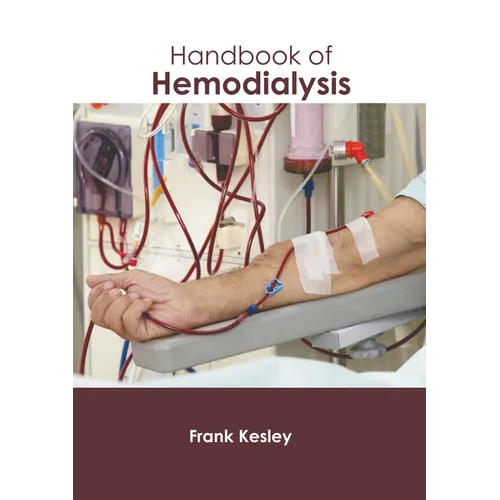 Handbook of Hemodialysis