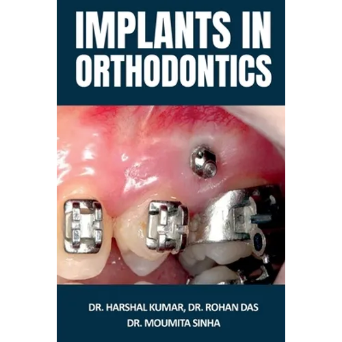 Implants in Orthodontics