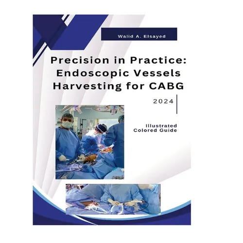Precision in Practice: Endoscopic Vessel Harvesting for CABG