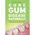 Cure Gum Disease Naturally: Heal Gingivitis and Periodontal Disease with Whole Foods