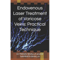 Endovenous Laser Treatment of Varicose Veins: Practical Technique