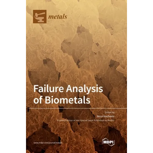 Failure Analysis of Biometals