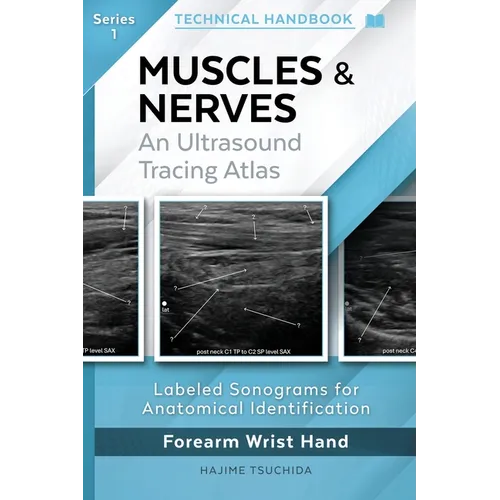 Muscles & Nerves - Technical Ultrasound Handbook: An Ultrasound Tracing Atlas (Series 1)