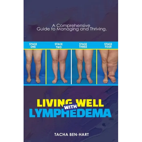Living Well with Lymphedema: A Comprehensive Guide to Managing and Thriving
