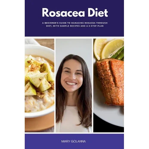 Rosacea Diet: A Beginner's Guide to Managing Rosacea Through Diet, With Sample Recipes and a 5-Step Plan