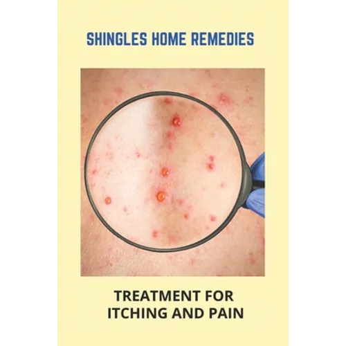 Shingles Home Remedies: Treatment For Itching And Pain: Shingles Recovery Stages