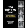 200 Chest X-Ray Cases