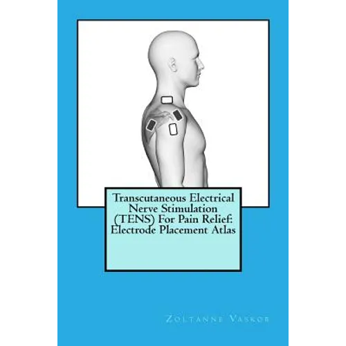 Transcutaneous Electrical Nerve Stimulation (TENS) For Pain Relief: Electrode Placement Atlas