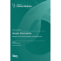 Atopic Dermatitis: Research and Clinical Updates and Perspectives